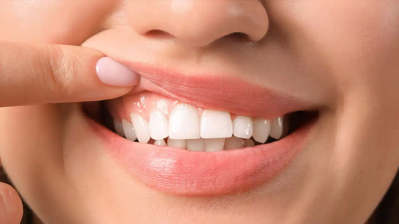 What Color Are Healthy Gums? - Valley Dental Care of Plainfield