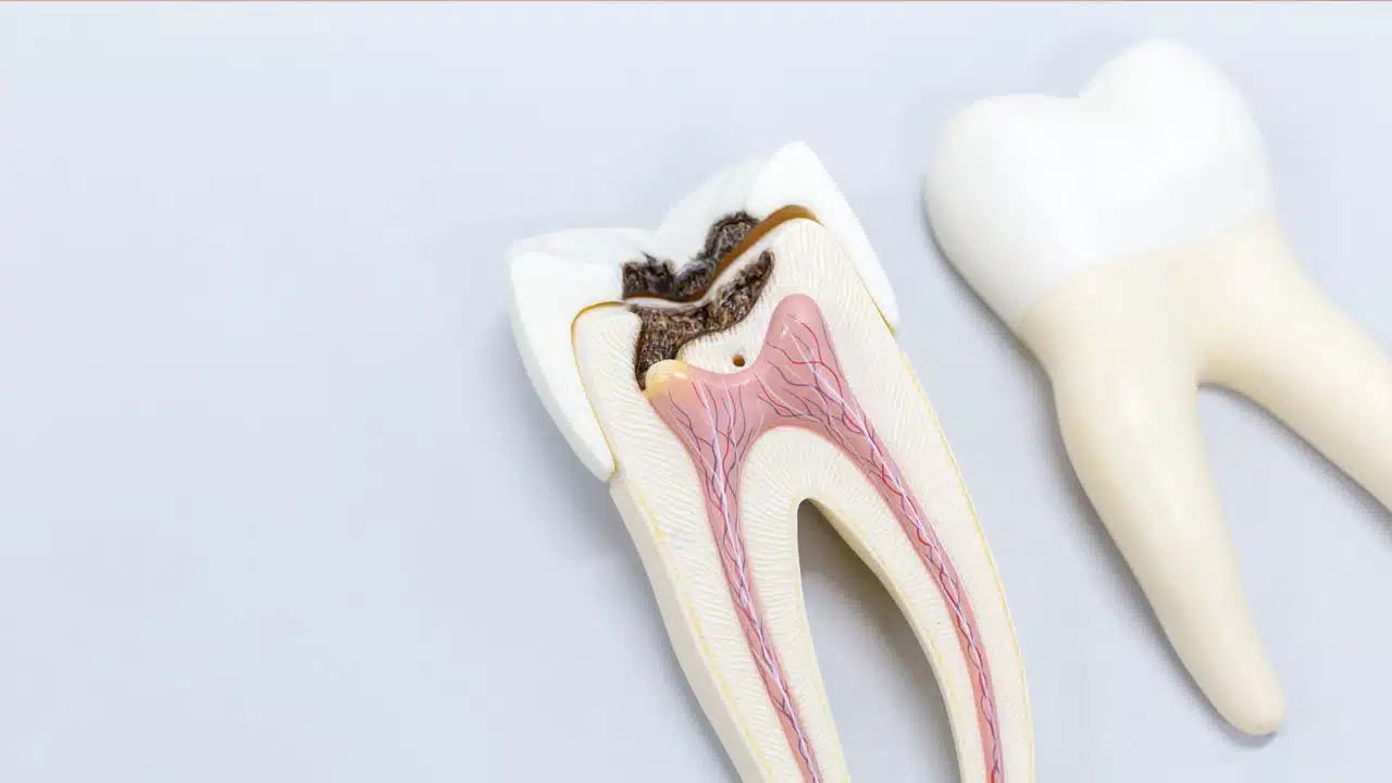 Tooth model for classroom education and in laboratory