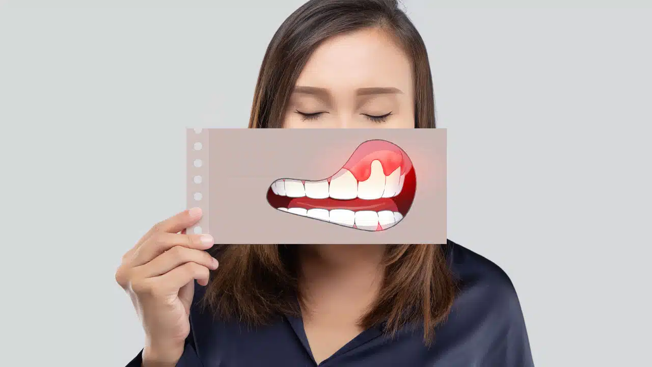 Woman holding cartoon sign with inflamed gums oral cancer