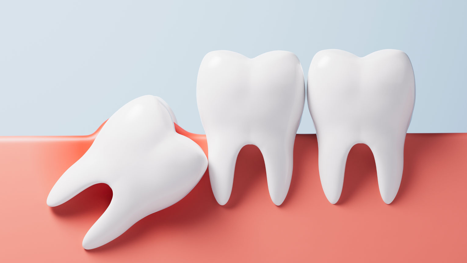 What to Eat After a Tooth Extraction
